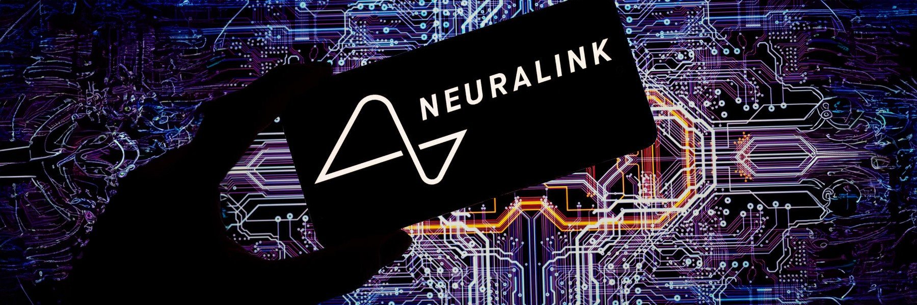Neuralink, la società di Musk ha installato il primo impianto cerebrale su un umano