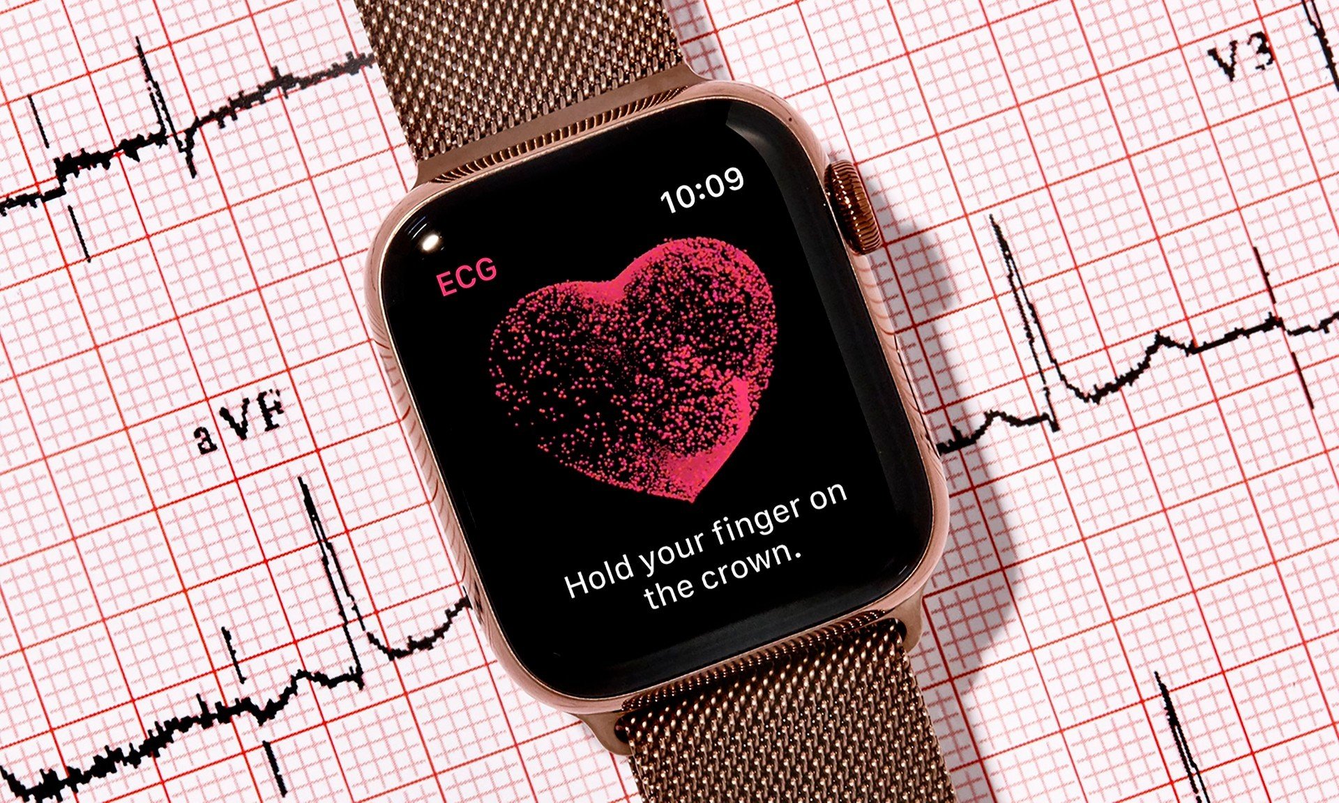 Apple vince la disputa legale con AliveCor: nessun divieto per l'Apple Watch