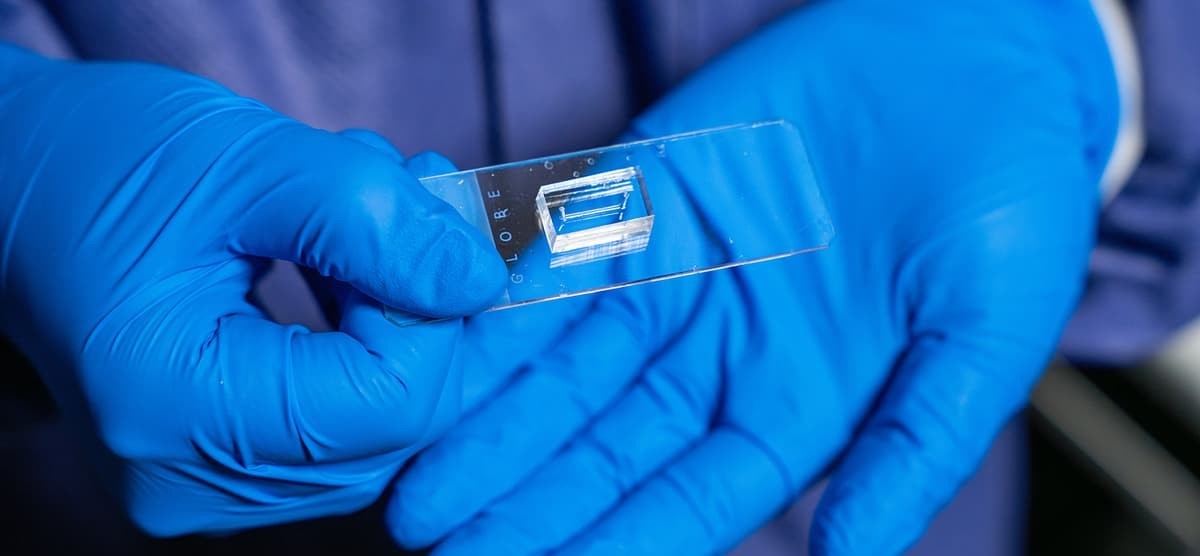 Chip vascolare in miniatura: nuove frontiere nella diagnosi cardiaca