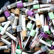 Plastiche contaminate da laboratori e ospedali, ma come avviene il riciclo?