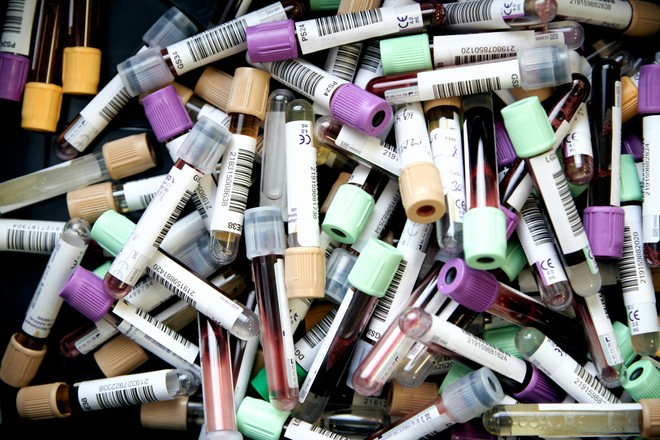 Anteprima: Plastiche contaminate da laboratori e ospedali, ma come avviene il riciclo?